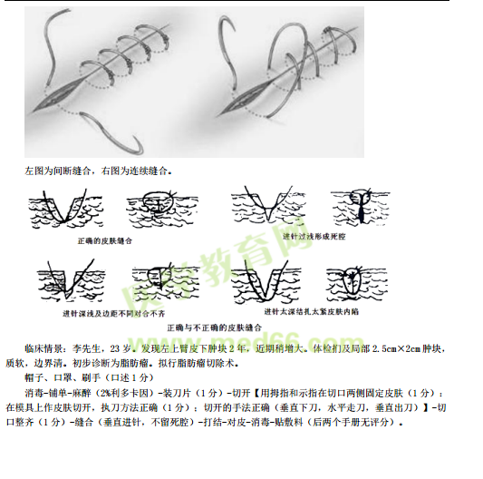 臨床助理醫(yī)師實踐技能考點-外科手術基本操作（附圖片）