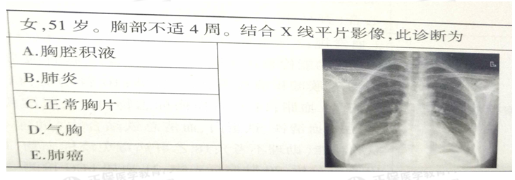 正常胸片